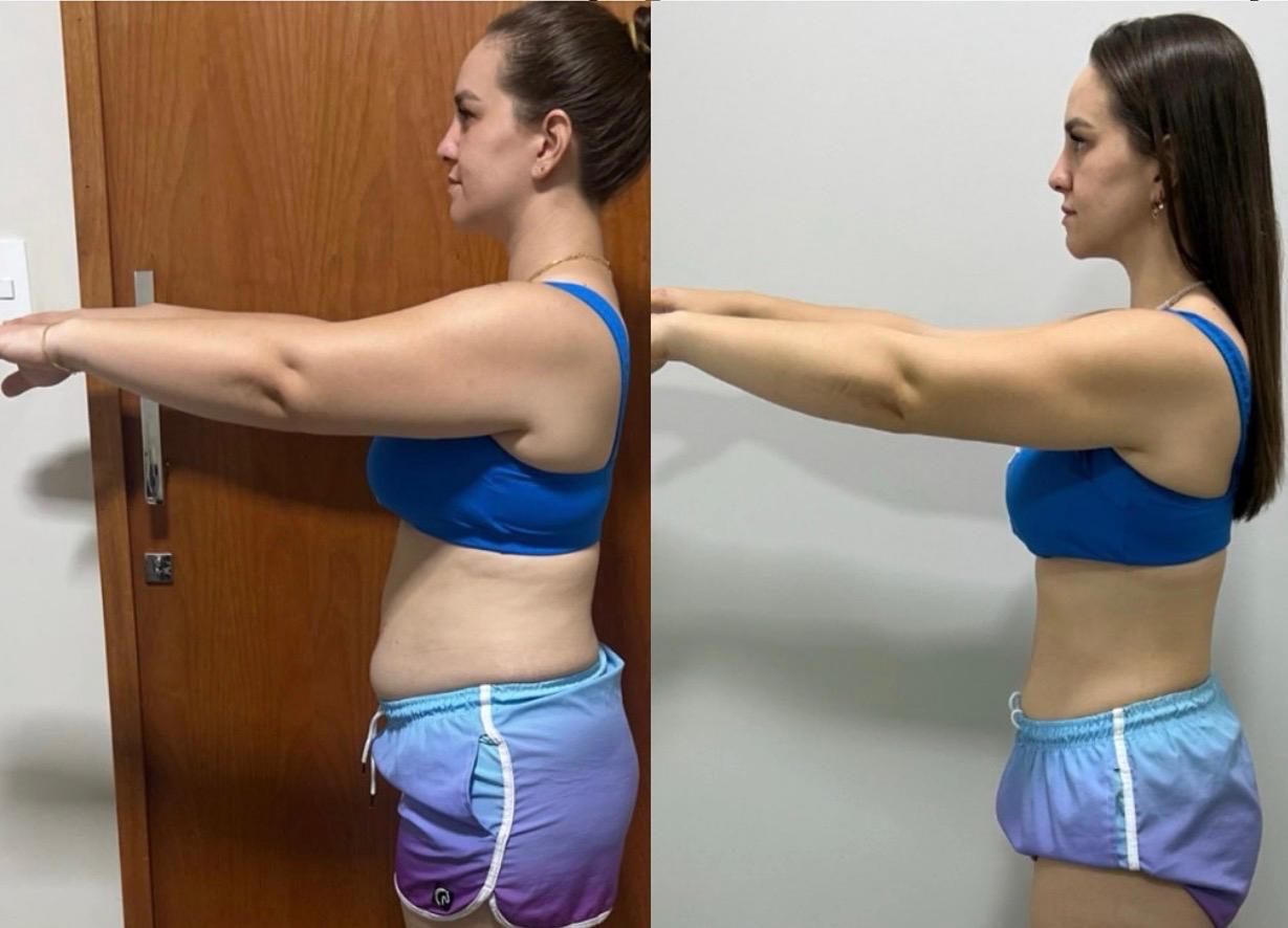 Comparação de evolução corporal lateral de uma aluna